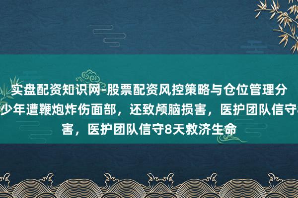 实盘配资知识网-股票配资风控策略与仓位管理分析 甘肃14岁少年遭鞭炮炸伤面部，还致颅脑损害，医护团队信守8天救济生命